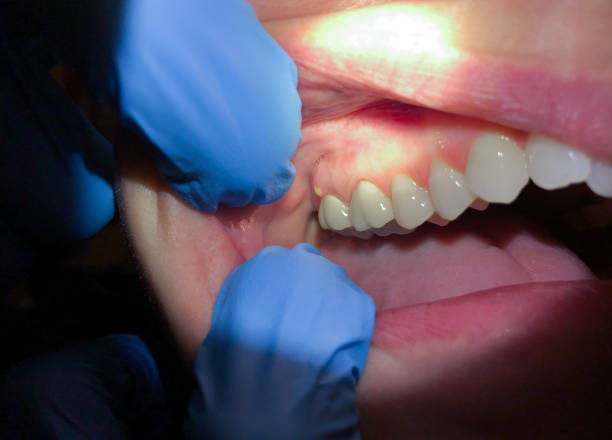Best Emergency Dental Care for Broken or Chipped Teeth in Conway, PA